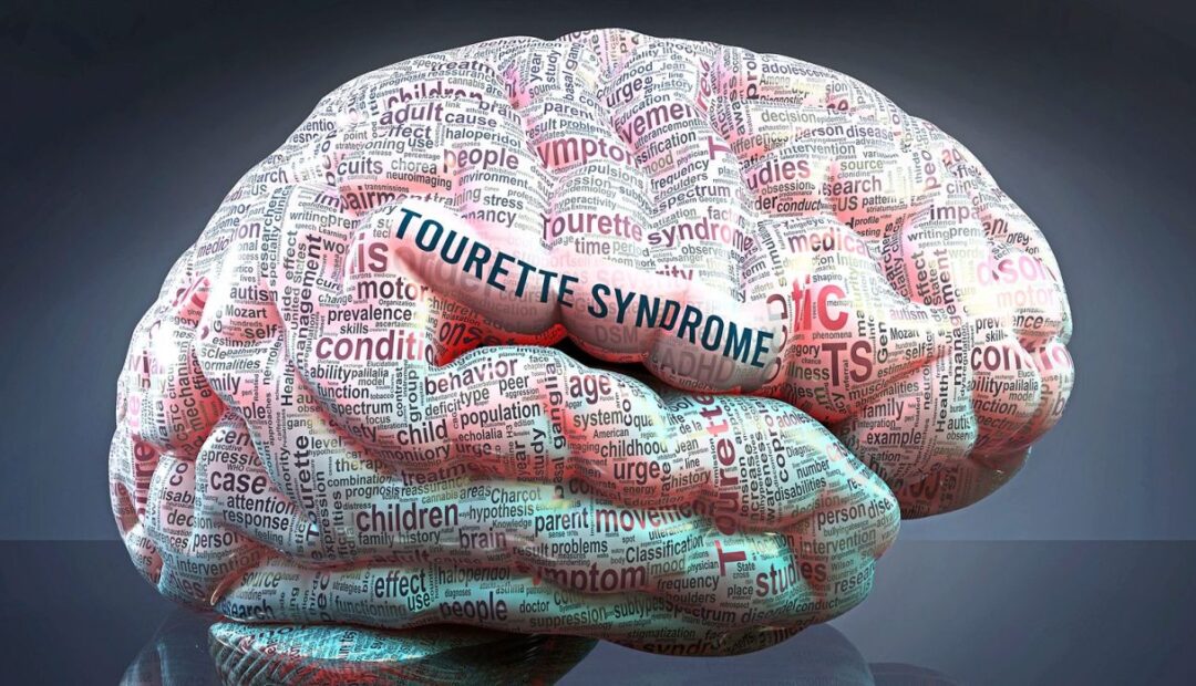 Σύνδρομο Tourette επισκόπηση, συμπτώματα, αιτίες, διάγνωση και θεραπεία